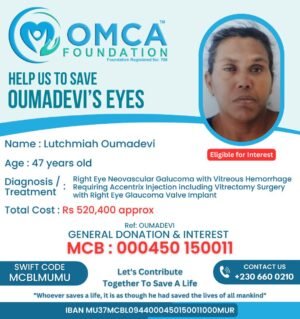help save oumadevi’s eyes – urgent eye surgery needed